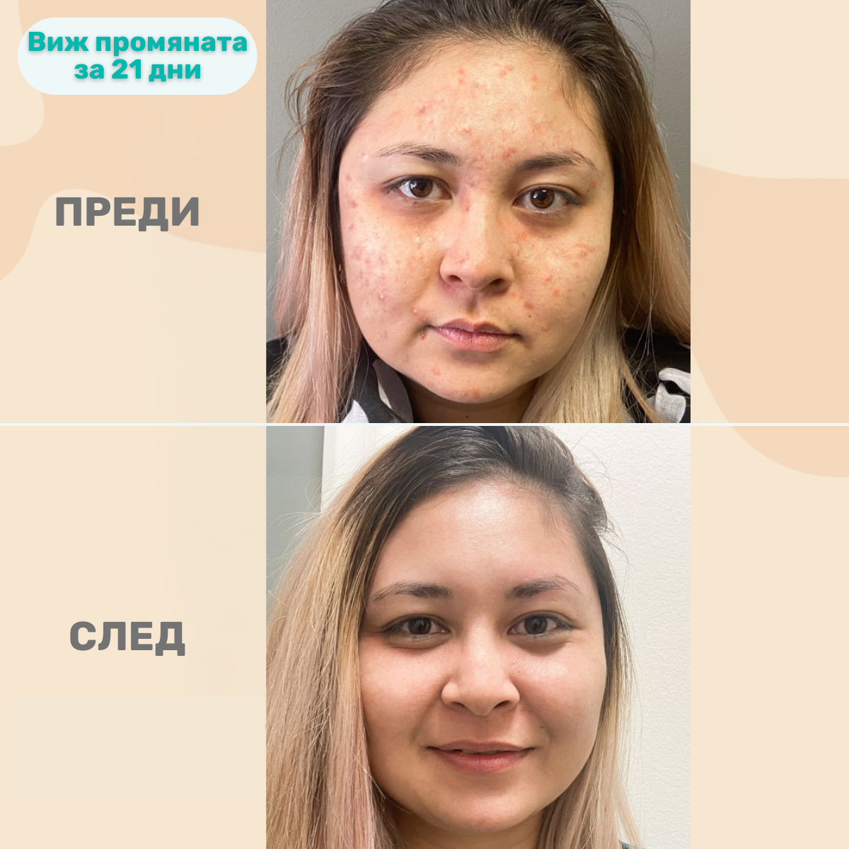beMe Коректор с двойно действие – Лекува и прикрива несъвършенствата
