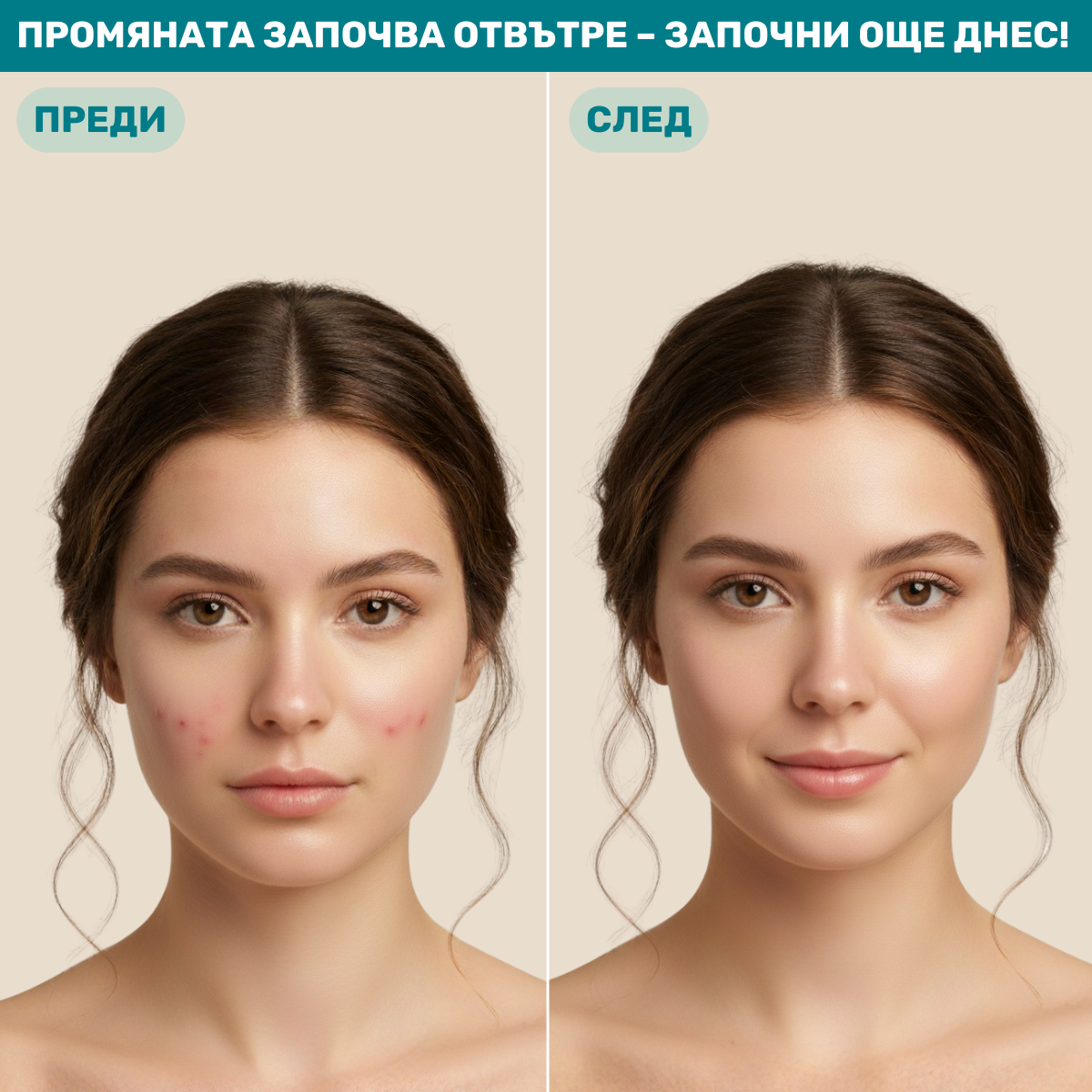beMe DermaBalance – Хранителна добавка за чиста и здрава кожа с пробиотици