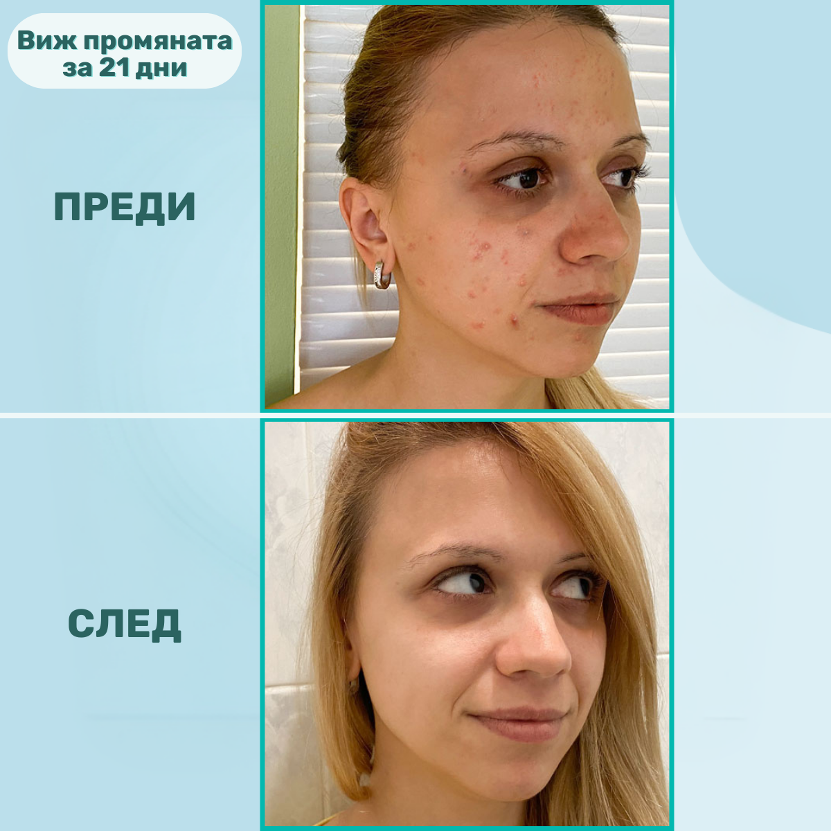 beMe Комплект 3в1 - Пълна рутина за чиста и здрава кожа
