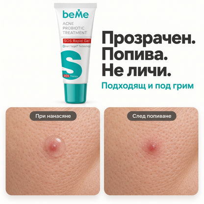 beMe SOS Rapid Gel – Спешна грижа за пъпки и белези
